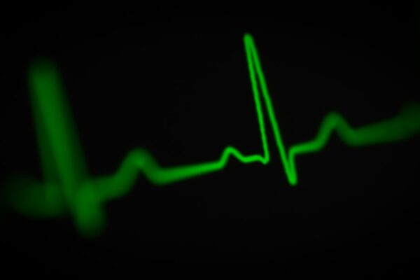 green heartbeat line on a black background